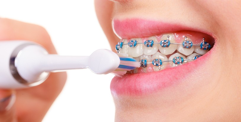 Brushing Techniques