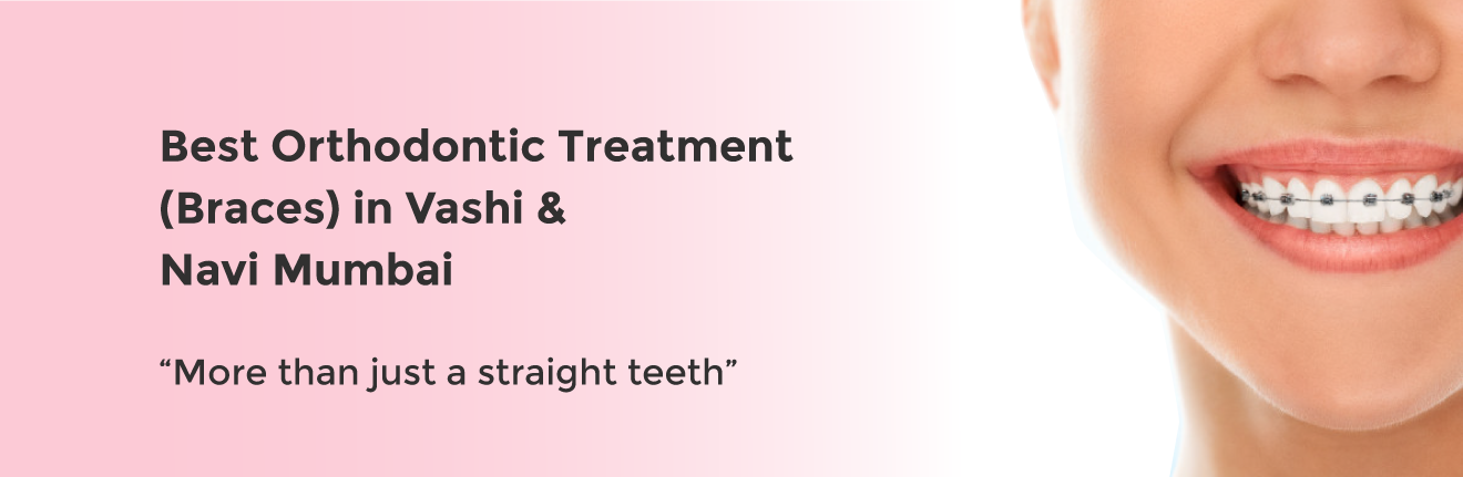 orthodontics-treatment-banner.png